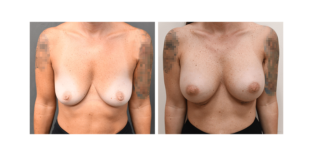 73296 case 5019 imageset 1 before after slide